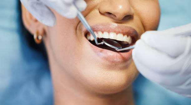Best Knocked-Out Tooth (Avulsed Tooth) Treatment in Loyal, WI