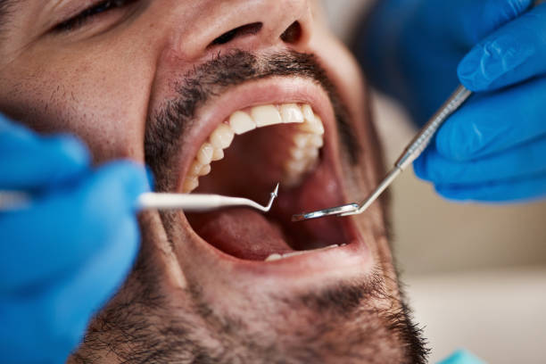 Best Emergency Denture Repair in Loyal, WI